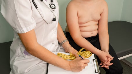 Severe childhood obesity has increased in the US: new study